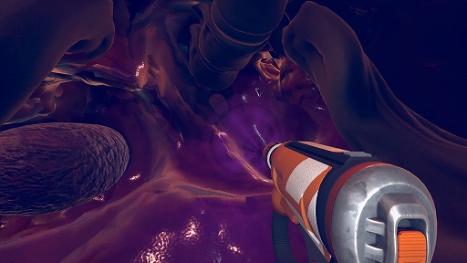 ���å��꡼�ʡ�